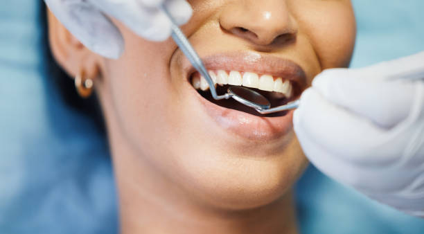 Best Emergency Treatment for Toothache in Tremonton, UT